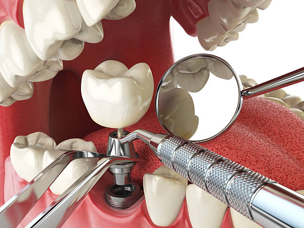 Best Emergency Dental Services for Seniors in West Yellowstone, MT